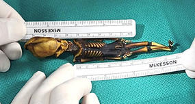 The 6" Human Skeleton Found in Atacama